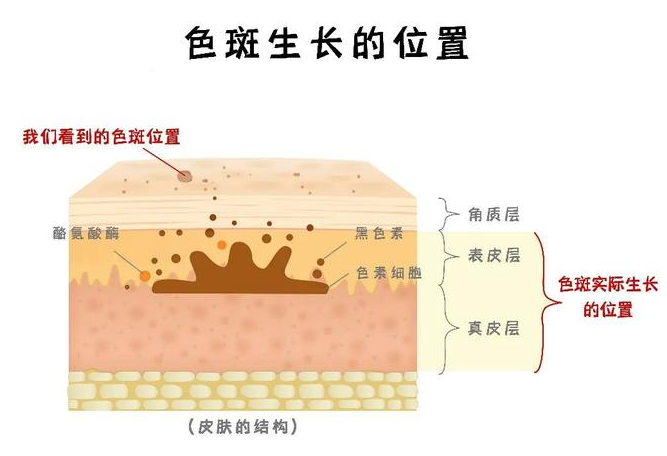 哪款大牌的淡斑精华效果最好|海淘高奢品牌淡斑精华排行榜